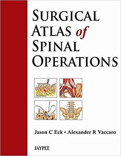 Download Surgical Atlas of Spinal Operations 1st Edition PDF