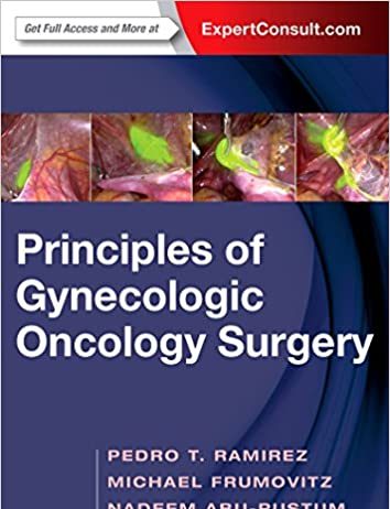 Principles of Gynecologic Oncology Surgery 1st Edition PDF