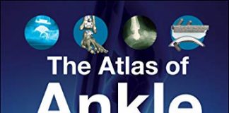 The Atlas of Ankle Replacements 1st Edition PDF