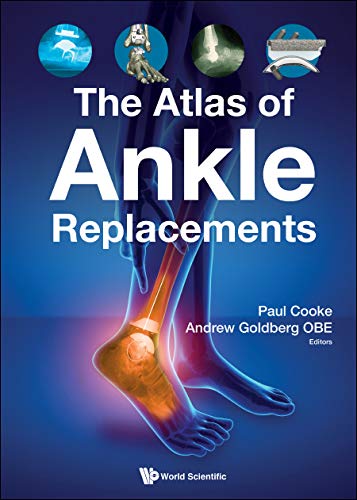 The Atlas of Ankle Replacements 1st Edition PDF