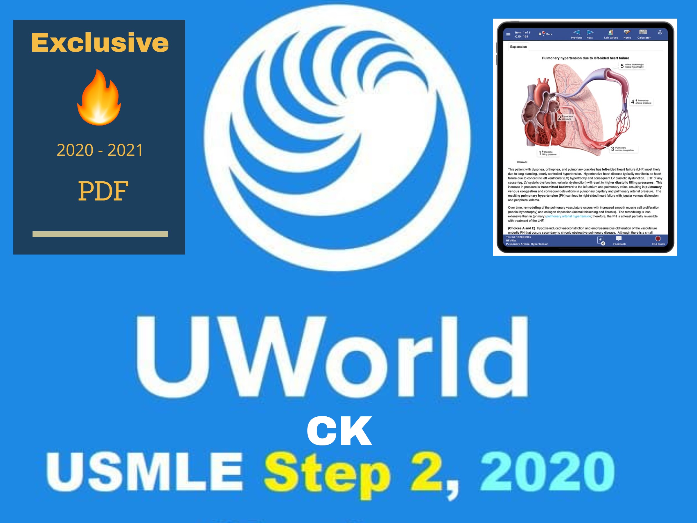 is thw uworld qbank harder than the usmle step 1