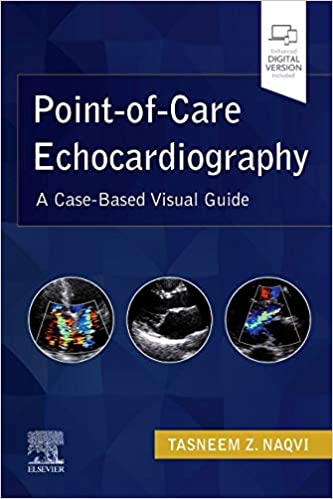 Point-of-Care Echocardiography A Clinical Case-Based Visual Guide 1st Edition PDF