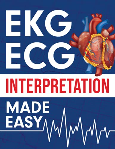 ECG Interpretation Made Easy PDF